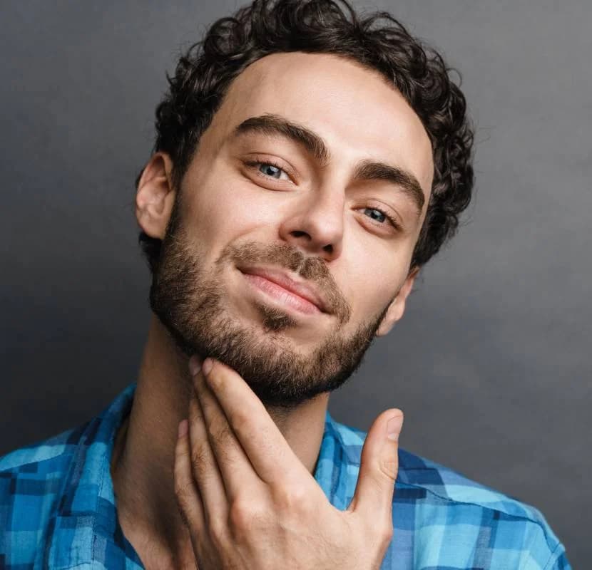 Beard transplant patient — fuller, natural-looking beard