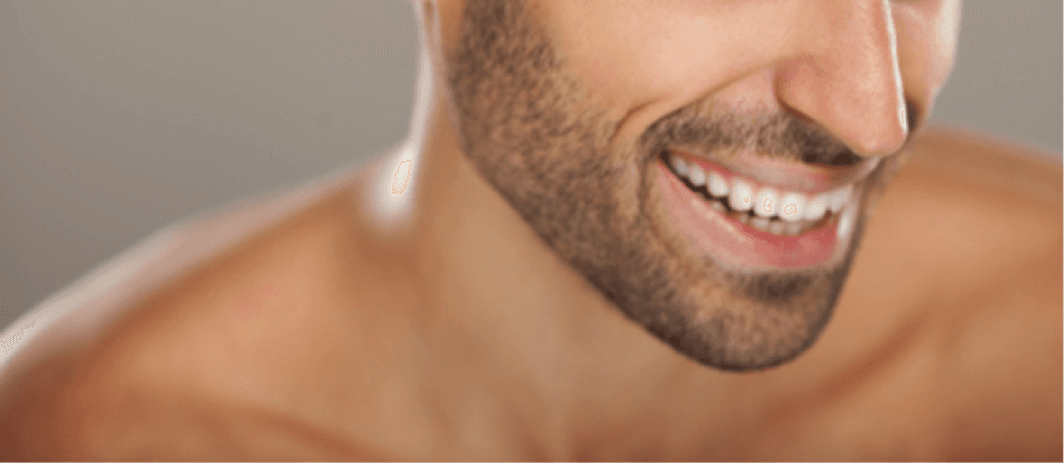 Beard transplant surgery