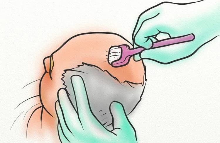 Hair Loss Prevention Treatments: Everything You Need to Know