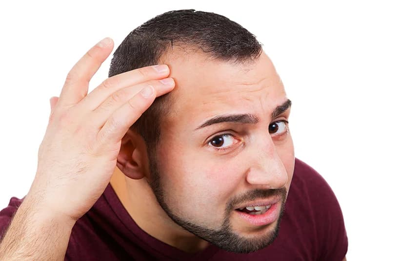 Is FUE The Best Male Hair Loss Solution?