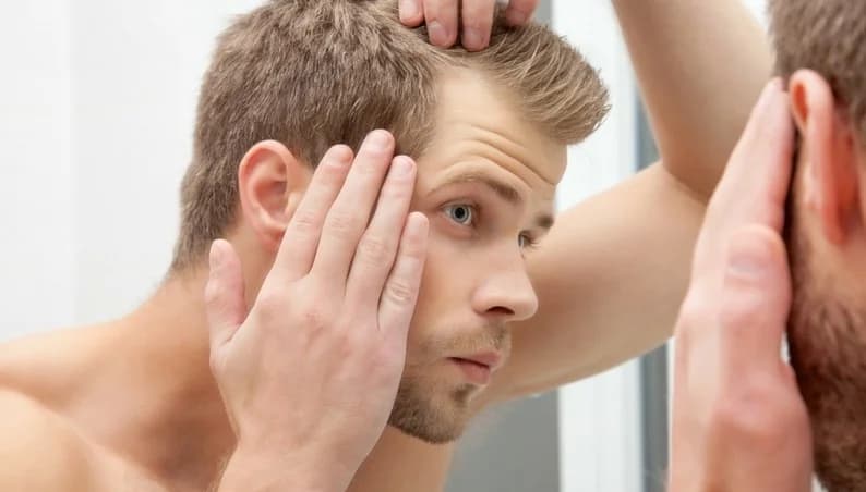 Am I losing hair?