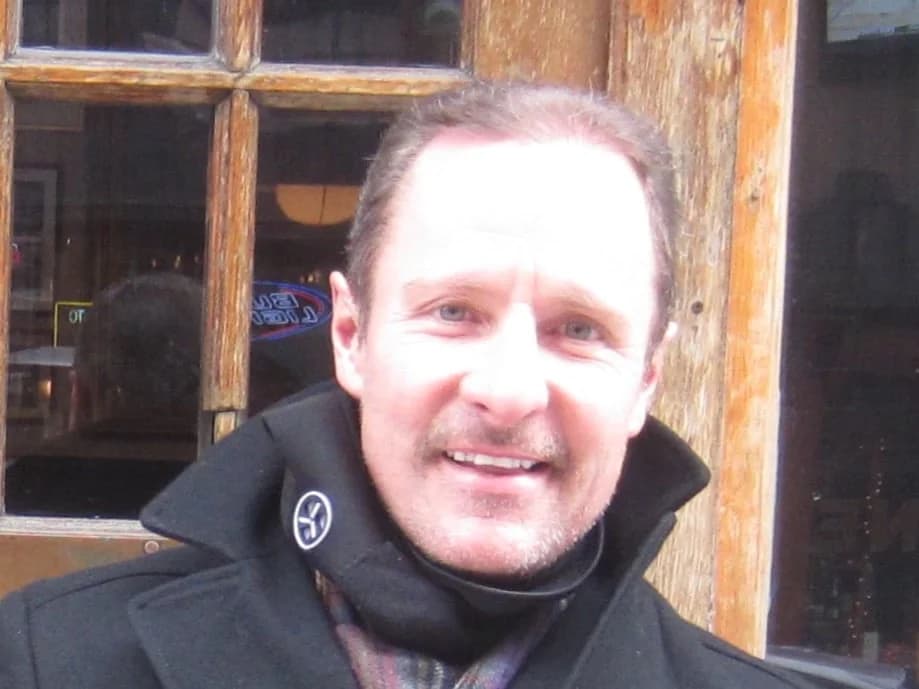 MICHAEL KAYE’S HAIR RESTORATION STORY