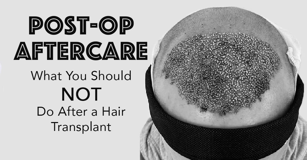 Post-op Aftercare: What You Should NOT Do After a Hair Transplant