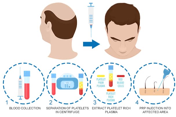 Advanced hair treatment process