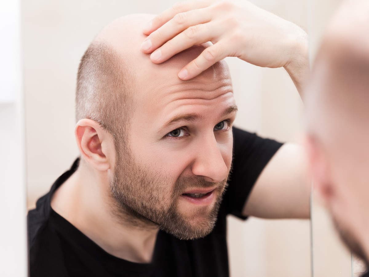 How To Avoid Hair Loss Scams