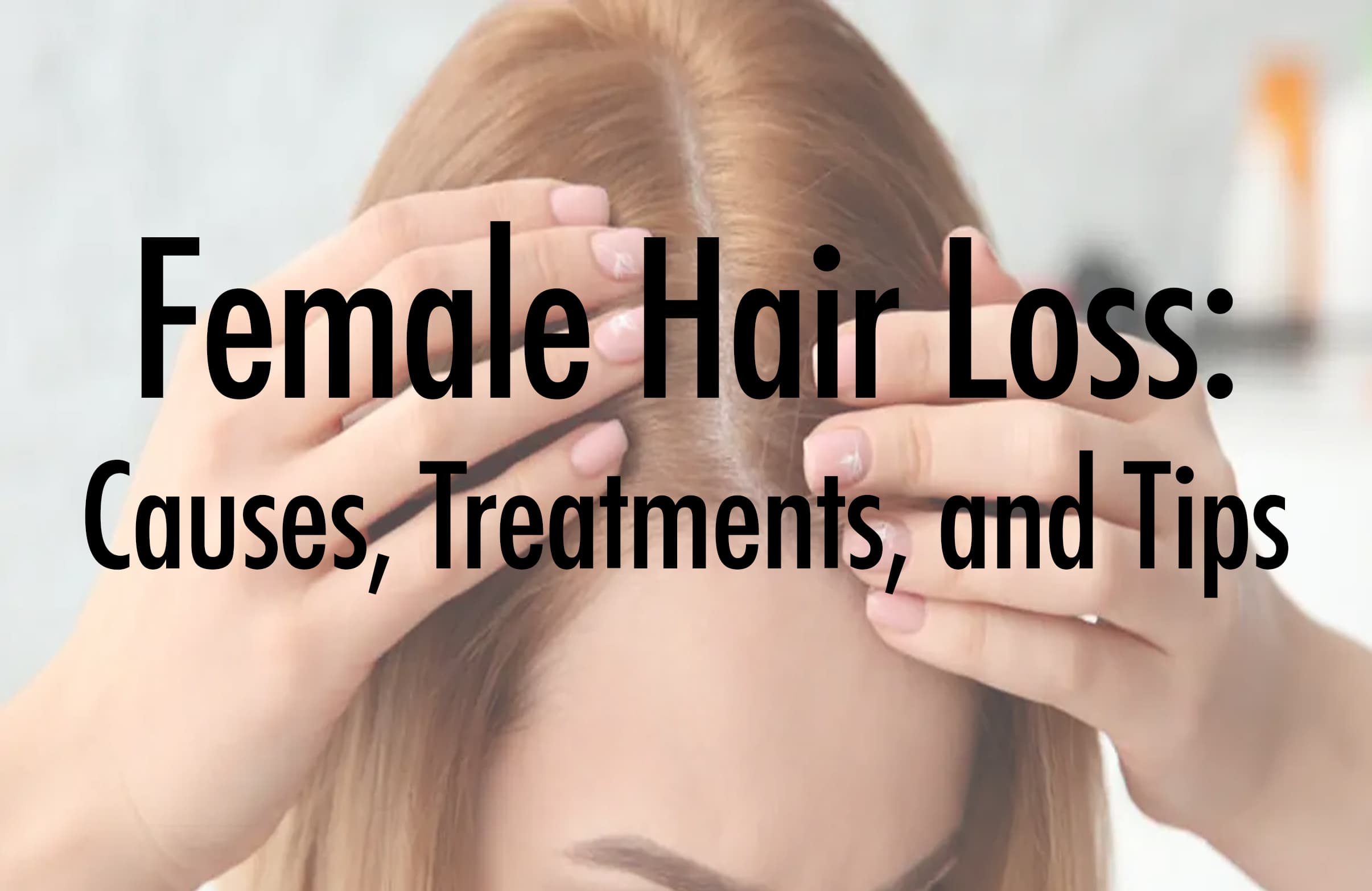Female Hair Loss: Causes, Treatments, and Tips