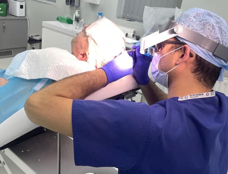 How Long Do Hair Transplants Last? (And Do They Always Work?)