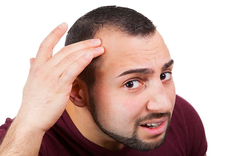 Is FUE The Best Male Hair Loss Solution?