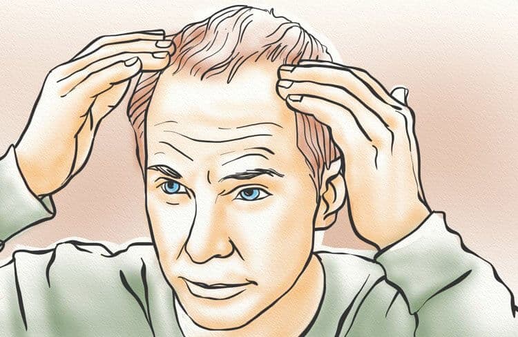 The Biggest Myths About Hereditary Hair Loss
