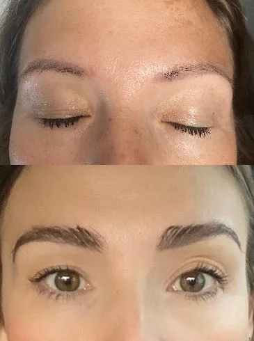 Eyebrow before and after