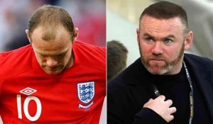 Wayne Rooney Hair Transplant