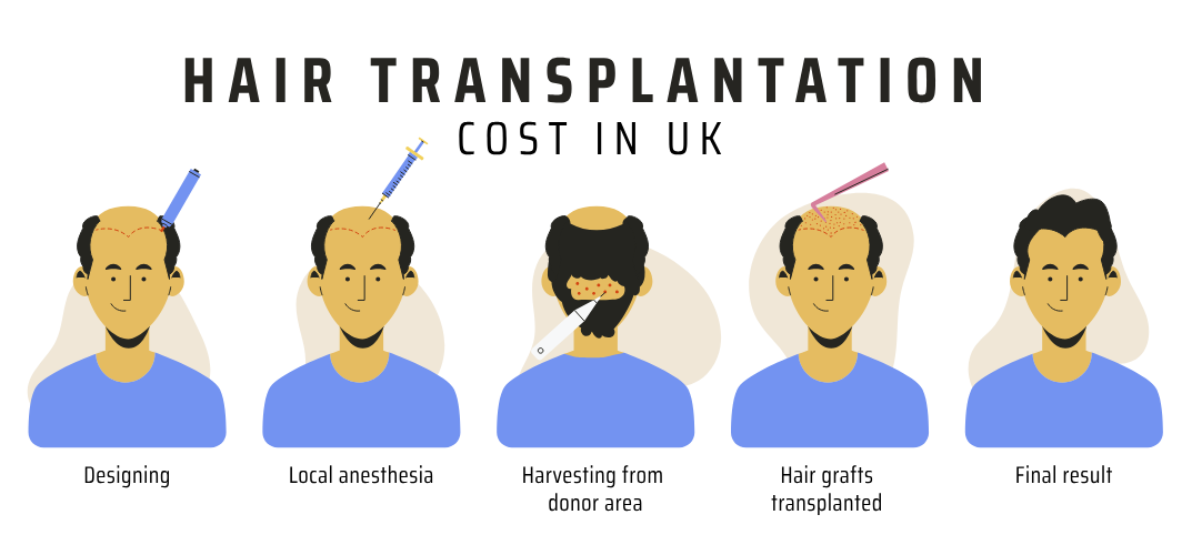 hair transplant cost in uk